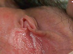 Волосатое затсиониро осие Договаривающихся ва мокрый